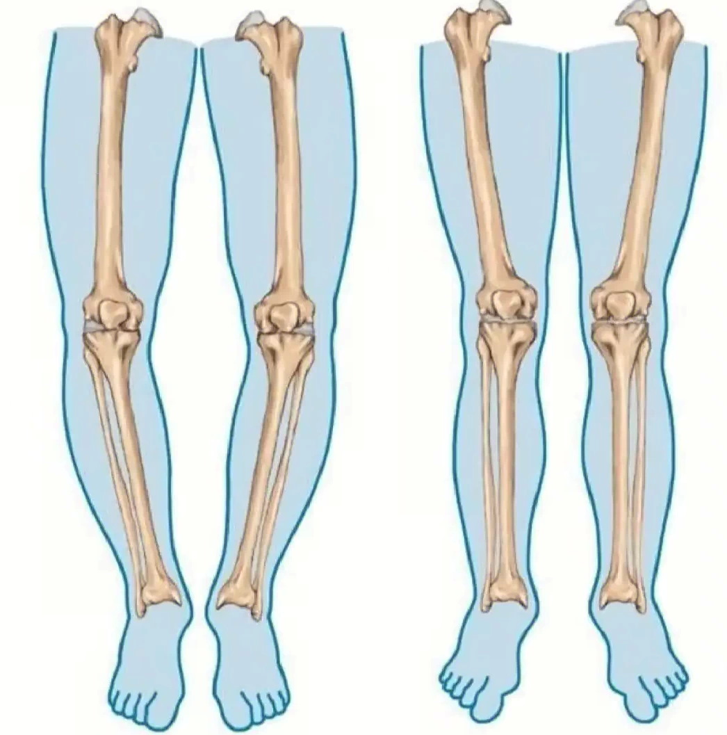 O leg 1