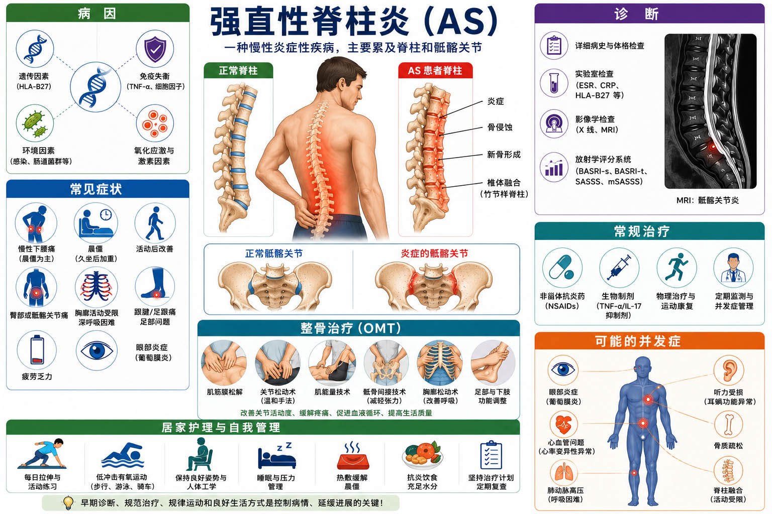 Anklosing Spondilitis Ch Anklosing Spondilitis Ch